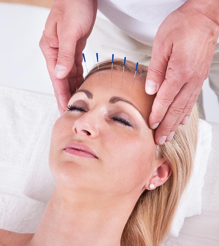 Facial Acupuncture: Benefits, How It Works, & Side Effects