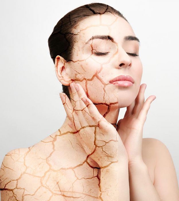 How To Use Multani Mitti For Dry Skin