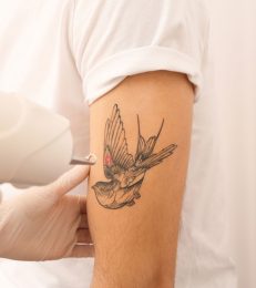 How To Fade A Tattoo: Natural Remedies & Medical Treatments