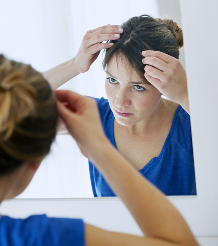 Scalp Psoriasis Vs. Dandruff: Differences, Causes, & Treatment